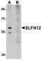 Schlafen Family Member 12 antibody, PA5-20867, Invitrogen Antibodies, Western Blot image 