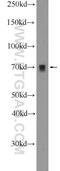 Breast Carcinoma Amplified Sequence 1 antibody, 25776-1-AP, Proteintech Group, Western Blot image 