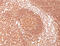 CD45 antibody, AM32866PU-T, Origene, Immunohistochemistry paraffin image 