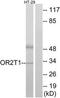 Olfactory Receptor Family 2 Subfamily T Member 1 antibody, TA315346, Origene, Western Blot image 