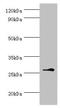 Baculoviral IAP Repeat Containing 8 antibody, orb353517, Biorbyt, Western Blot image 
