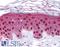 Stromelysin-2 antibody, LS-B874, Lifespan Biosciences, Immunohistochemistry paraffin image 