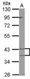 Peroxisomal 3,2-trans-enoyl-CoA isomerase antibody, NBP2-19766, Novus Biologicals, Western Blot image 