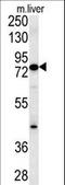 Methylcrotonoyl-CoA Carboxylase 1 antibody, LS-C164080, Lifespan Biosciences, Western Blot image 