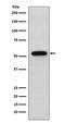Syntrophin Alpha 1 antibody, M05370-1, Boster Biological Technology, Western Blot image 
