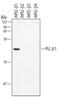 Phospholipase C Beta 1 antibody, PA5-48052, Invitrogen Antibodies, Western Blot image 