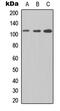 FCRH5 antibody, abx121576, Abbexa, Western Blot image 