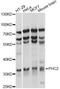 Polyhomeotic Homolog 2 antibody, LS-C749712, Lifespan Biosciences, Western Blot image 