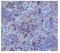 NADPH oxidase 5 antibody, A03119, Boster Biological Technology, Immunohistochemistry paraffin image 