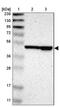 TBC1 Domain Family Member 10A antibody, PA5-52517, Invitrogen Antibodies, Western Blot image 
