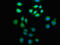 ADP Ribosylation Factor Guanine Nucleotide Exchange Factor 2 antibody, LS-C673673, Lifespan Biosciences, Immunofluorescence image 