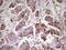 Epithelial Cell Transforming 2 antibody, M01862-1, Boster Biological Technology, Immunohistochemistry paraffin image 