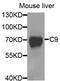 Complement C9 antibody, abx006787, Abbexa, Western Blot image 