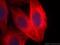 alpha-Tubulin antibody, YF594-66031, Proteintech Group, Immunofluorescence image 