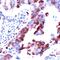 Ribosomal Protein S6 antibody, PA5-32578, Invitrogen Antibodies, Immunohistochemistry frozen image 