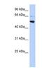 Adaptor Related Protein Complex 3 Subunit Mu 2 antibody, NBP1-56624, Novus Biologicals, Western Blot image 