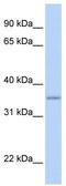 Glyoxylate reductase/hydroxypyruvate reductase antibody, TA346615, Origene, Western Blot image 