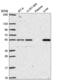 Zinc finger protein GLIS2 antibody, NBP2-54964, Novus Biologicals, Western Blot image 