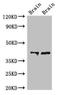 Calcium/Calmodulin Dependent Protein Kinase I antibody, orb51546, Biorbyt, Western Blot image 