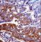 GC-A antibody, LS-C164506, Lifespan Biosciences, Immunohistochemistry paraffin image 