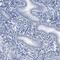 Acid Phosphatase, Prostate antibody, HPA004335, Atlas Antibodies, Immunohistochemistry frozen image 