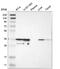 Capping Actin Protein Of Muscle Z-Line Subunit Alpha 2 antibody, NBP2-58907, Novus Biologicals, Western Blot image 
