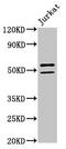 NOVA Alternative Splicing Regulator 1 antibody, LS-C670860, Lifespan Biosciences, Western Blot image 