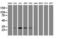 Proteasome Subunit Beta 7 antibody, LS-C787005, Lifespan Biosciences, Western Blot image 