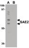 Ubiquitin Like Modifier Activating Enzyme 2 antibody, PA5-20958, Invitrogen Antibodies, Western Blot image 