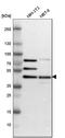 SWI/SNF-related matrix-associated actin-dependent regulator of chromatin subfamily B member 1 antibody, HPA018248, Atlas Antibodies, Western Blot image 