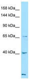 Latent Transforming Growth Factor Beta Binding Protein 4 antibody, TA338330, Origene, Western Blot image 