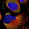 Par-6 Family Cell Polarity Regulator Beta antibody, NBP1-87337, Novus Biologicals, Immunocytochemistry image 