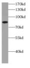 Carnosine Synthase 1 antibody, FNab01276, FineTest, Western Blot image 