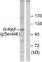 Serine/threonine-protein kinase B-raf antibody, TA326162, Origene, Western Blot image 