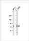 Mannosidase Alpha Class 1A Member 2 antibody, PA5-49549, Invitrogen Antibodies, Western Blot image 