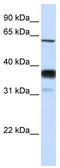 Sphingomyelin phosphodiesterase 3 antibody, TA331049, Origene, Western Blot image 