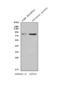 Ubiquitin Specific Peptidase 44 antibody, A08401-2, Boster Biological Technology, Western Blot image 