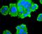 FAS antibody, NBP2-66833, Novus Biologicals, Immunocytochemistry image 