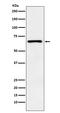 Parathyroid Hormone 1 Receptor antibody, M01588, Boster Biological Technology, Western Blot image 
