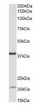 Kelch Domain Containing 8B antibody, orb125100, Biorbyt, Western Blot image 