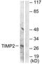 Metalloproteinase inhibitor 2 antibody, TA313021, Origene, Western Blot image 