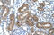 Suppressor Of Cytokine Signaling 1 antibody, ARP42147_T100, Aviva Systems Biology, Immunohistochemistry paraffin image 
