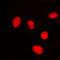 Lamin A/C antibody, LS-C352468, Lifespan Biosciences, Immunofluorescence image 