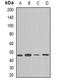 Leucine Rich Repeat Containing G Protein-Coupled Receptor 5 antibody, orb84937, Biorbyt, Western Blot image 