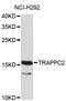 Trafficking Protein Particle Complex 2 antibody, STJ25959, St John