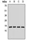 Ribosomal Protein L23a antibody, LS-C667670, Lifespan Biosciences, Western Blot image 
