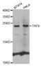 TATA-Box Binding Protein Associated Factor 9 antibody, abx001640, Abbexa, Western Blot image 