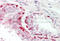 Heat shock 70 kDa protein 1A/1B antibody, ARP63869_P050, Aviva Systems Biology, Immunohistochemistry paraffin image 
