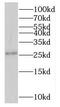 Nicotinamide Nucleotide Adenylyltransferase 3 antibody, FNab05768, FineTest, Western Blot image 