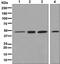 ERCC Excision Repair 8, CSA Ubiquitin Ligase Complex Subunit antibody, ab137033, Abcam, Western Blot image 